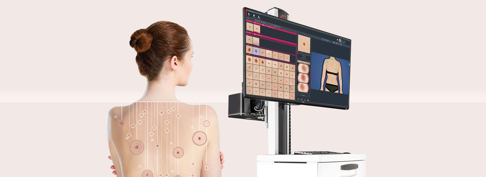 Dermatoskop Fotofinder přístroj pro vyšetření znamének